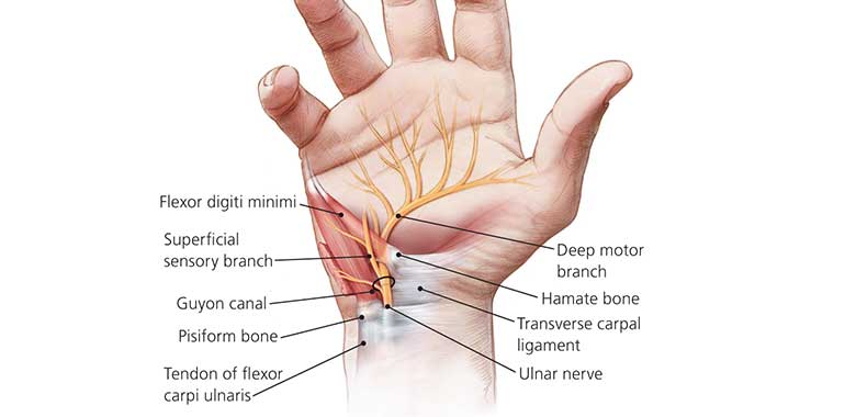 Kıvırıcı Tendon Yaralanmaları