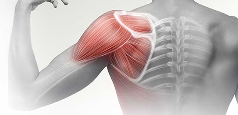 Omuz Kas Yırtıkları