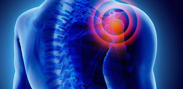 Proksimal Homeros Kırıkları (Ters Omuz Protezi)