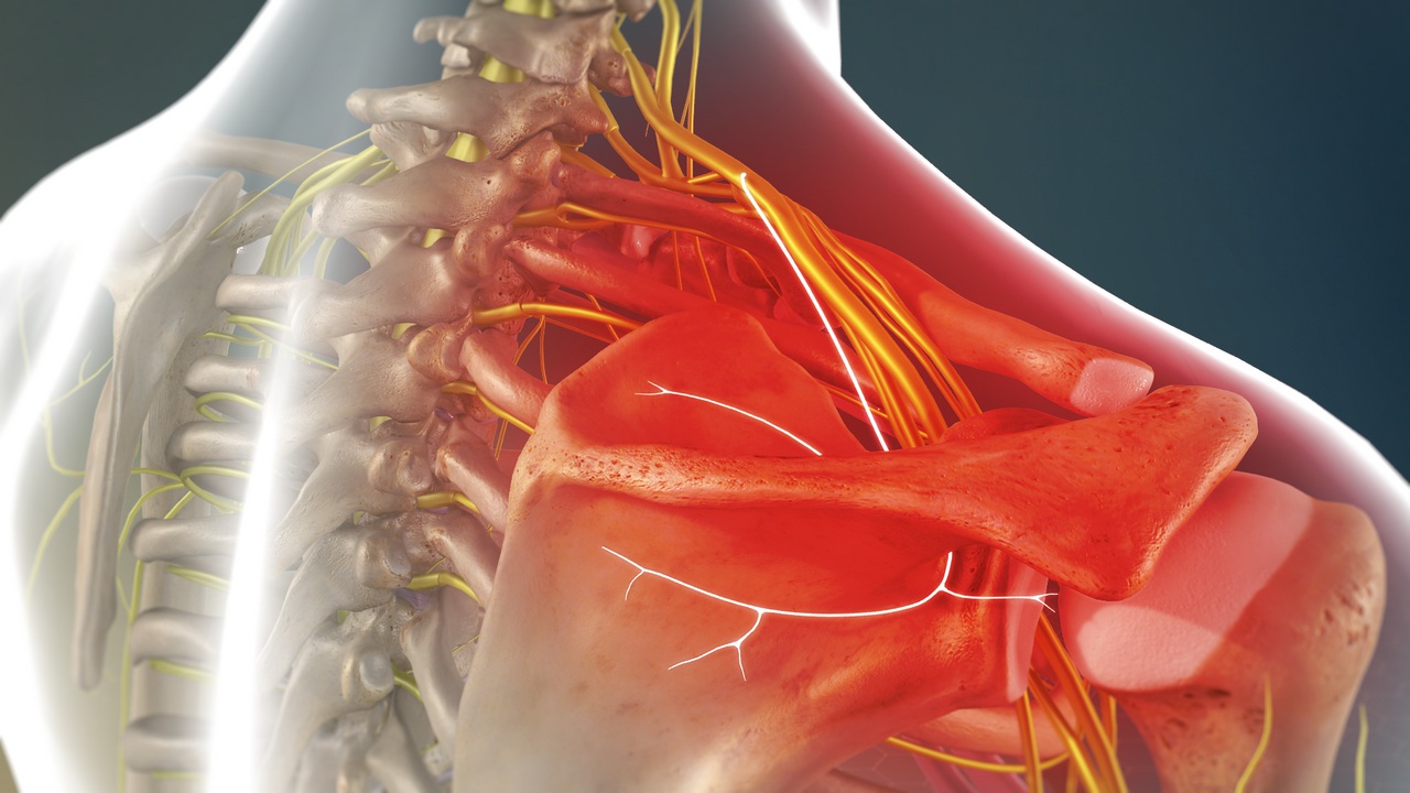Tuzak Nöropati Nedir?